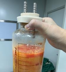 黄冈水动力吸脂手术要做多久？
